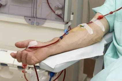 „Ne možemo više šutjeti dok pacijenti umiru u tišini“: Alarm iz centara za dijalizu u RS-u