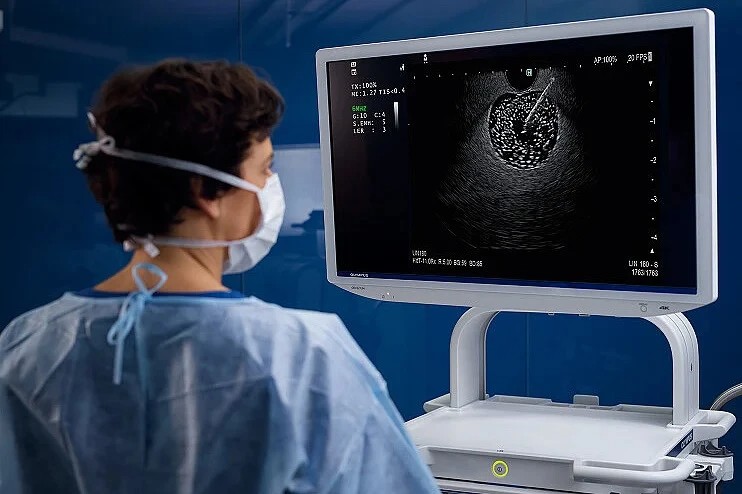 Endoskopski ultrazvuk (EUS) dostupan u poliklinici Vitalis Mostaru