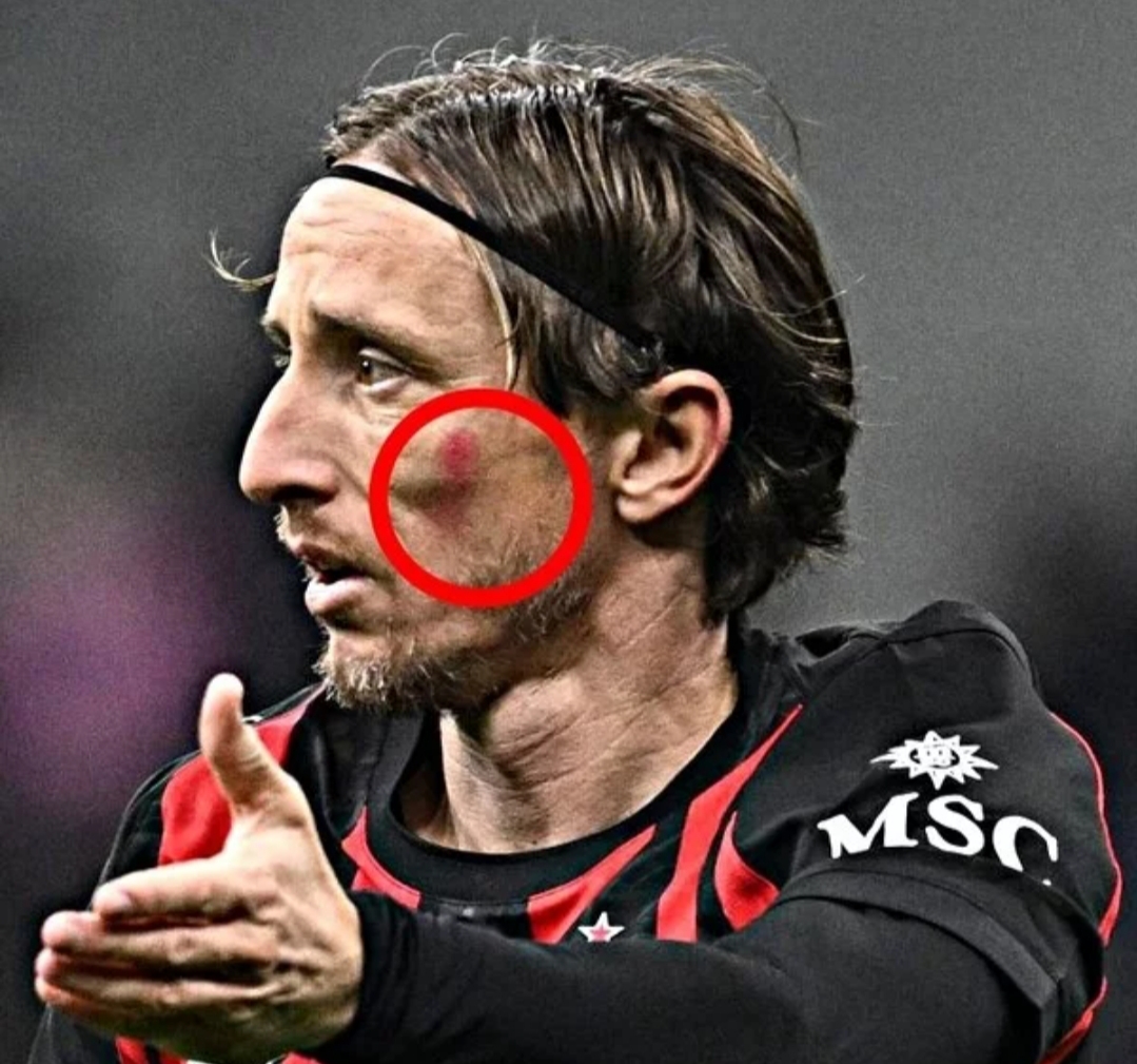 Luka Modrić i Petar Sučić imali su crvene mrlje na licu na velikom derbiju: Znate li zašto?
